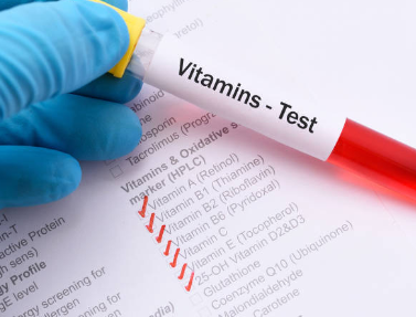 vitamins test